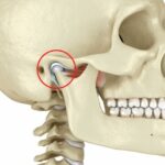 Anatomía de la articulación temporomandibular