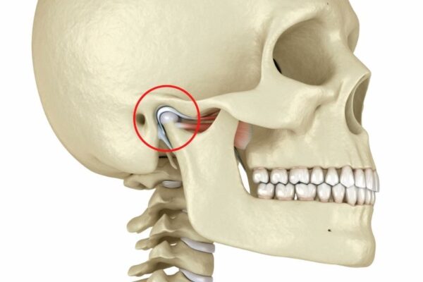 Anatomía de la articulación temporomandibular