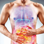 Disbiosis intestinal como eje diagnóstico y terapéutico en la fisiopatología de la enfermedad