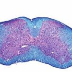 Sistematización de la sustancia gris