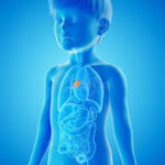 Quistes y tumores del timo en niños