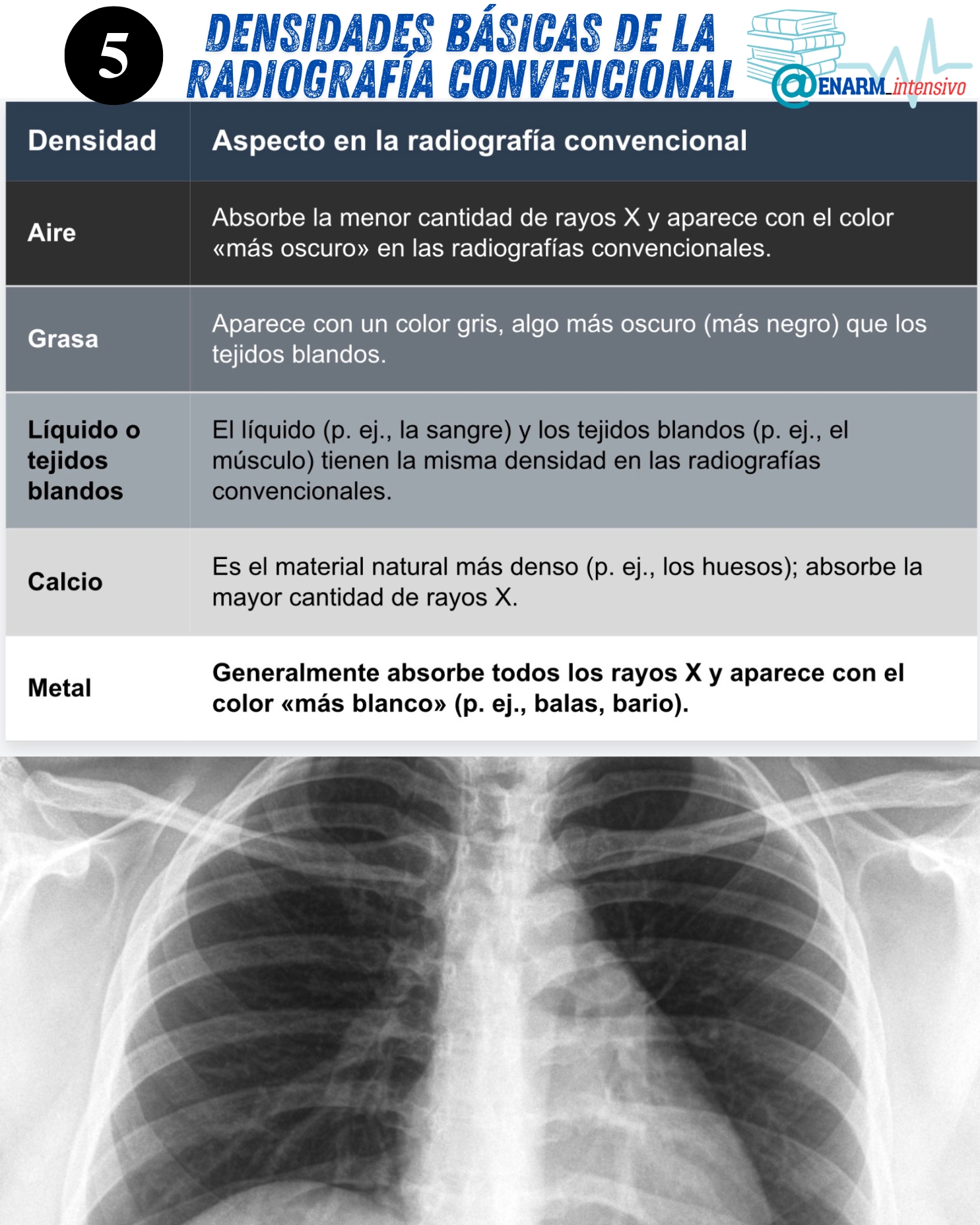 5 densidades básicas de la radiografía convencional