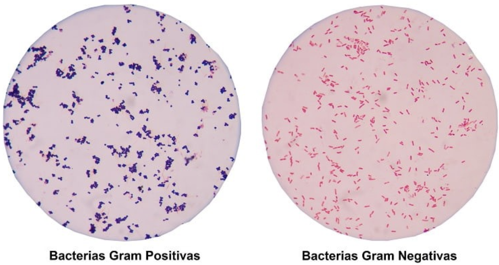 Bacterias Gram positivas y Gram negativas