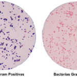 Bacterias Gram positivas y Gram negativas