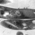 Bacterias con Estructuras de Pared Celular Alternativas