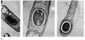 Endosporas bacterianas