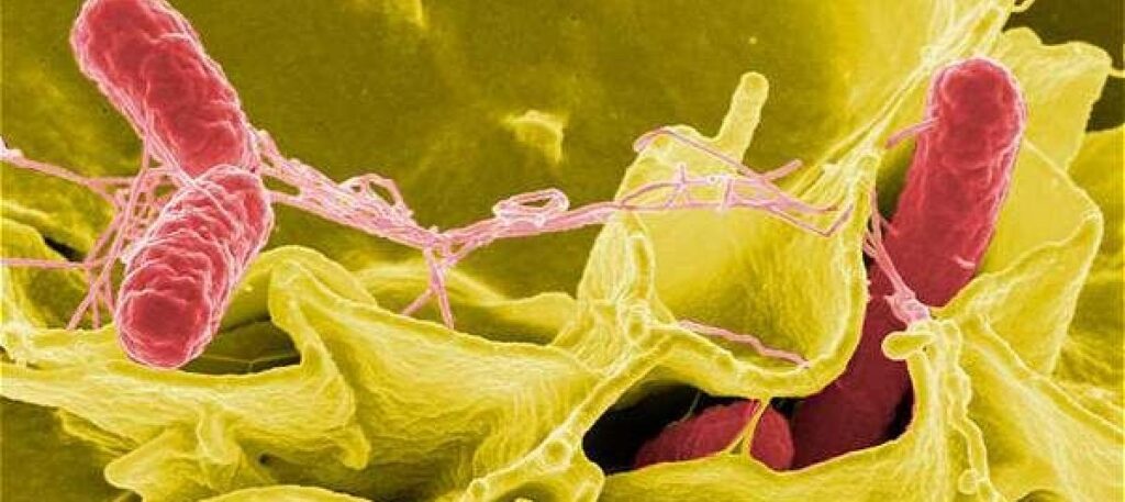 Mecanismos de la Patogénesis Bacteriana