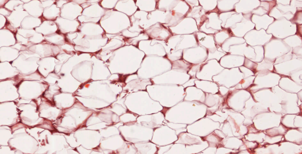 Funciones del tejido adiposo blanco