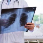 Cómo identificar una radiografía de tórax con técnica aceptable