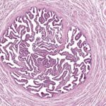 Histología de las tubas uterinas