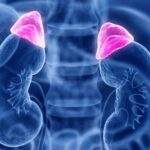 Suprarrenalectomía transabdominal anterior abierta