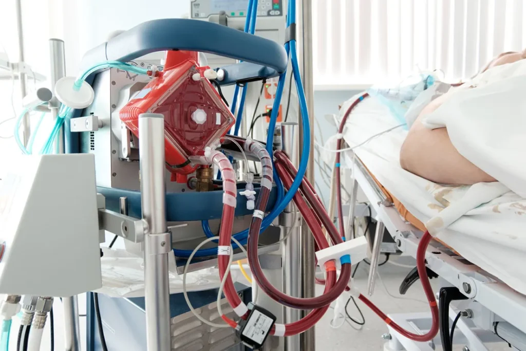 ¿Qué es el ECMO?