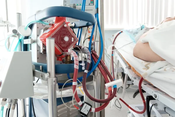 ¿Qué es el ECMO?