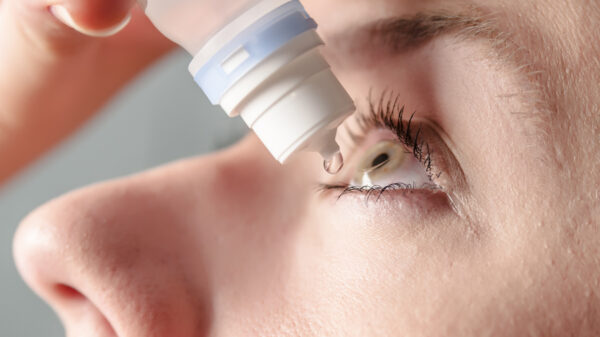 Ácido hialurónico en el tratamiento del ojo seco