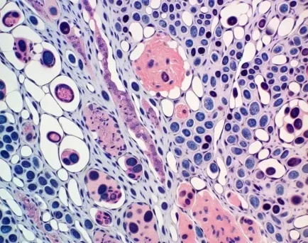 Nichos hematopoyéticos en la médula ósea