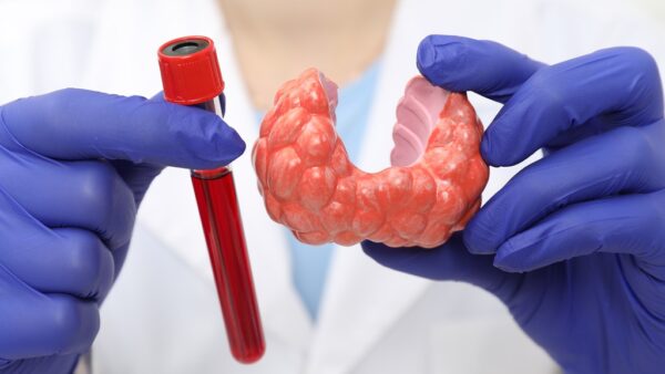 Biomarcadores tiroideos