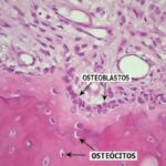 Especialización funcional de los osteoblastos