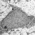 Diferenciación osteogénica de las células madre mesenquimales
