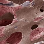 Bases biológicas en la reparación de defectos óseos