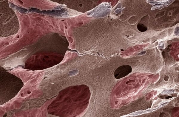 Bases biológicas en la reparación de defectos óseos