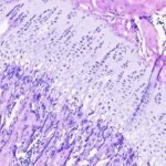 Osificación endocondral