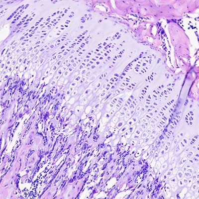 Osificación endocondral