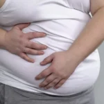 Papel de la obesidad en la formación de cálculos biliares