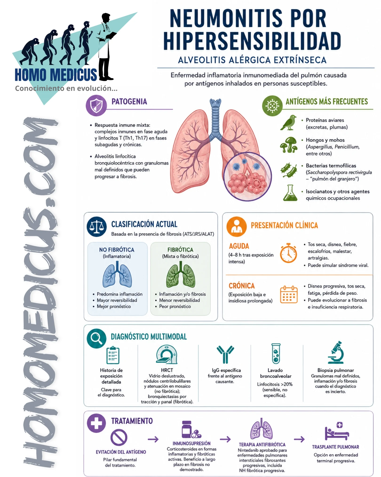 Alveolitis por hipersensivilidad