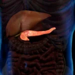Clasificación de las pancreatitis